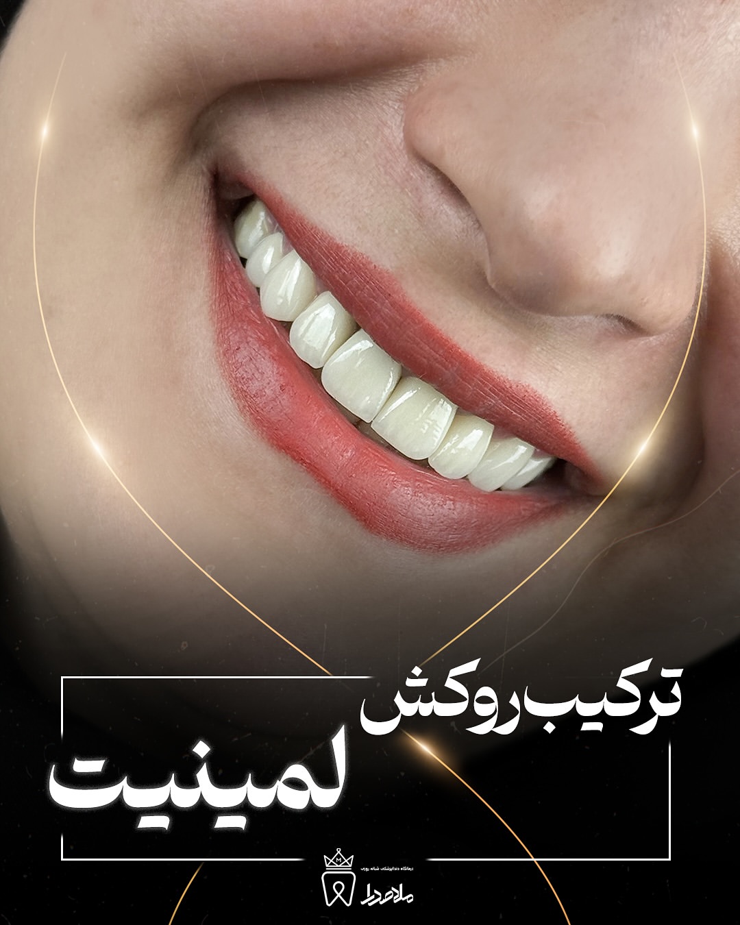 بازسازی طرح لبخند